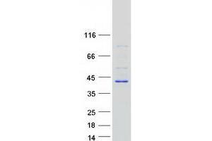 Validation with Western Blot