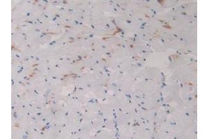 Immunohistochemistry (IHC) image for anti-serpin Peptidase Inhibitor, Clade A (Alpha-1 Antiproteinase, Antitrypsin), Member 6 (SERPINA6) (AA 267-390) antibody (ABIN7438400)