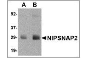 Western blot analysis of NIPSNAP2 in human skeletal muscle tissue lysate with this product at (A) 0. (GBAS Antikörper  (N-Term))