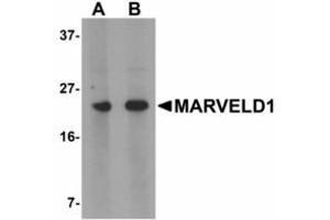 Image no. 1 for anti-MARVEL Domain Containing 1 (MARVELD1) (N-Term) antibody (ABIN478203) (MARVELD1 Antikörper  (N-Term))