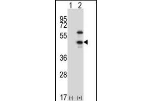 Western blot analysis of CDKL1 (arrow) using rabbit polyclonal CDKL1 Antibody  (ABIN391762 and ABIN2841627). (CDKL1 Antikörper  (C-Term))