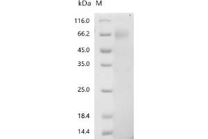 Interleukin 18 Binding Protein (IL18BP) (AA 31-194), (full length) protein (hFc Tag)