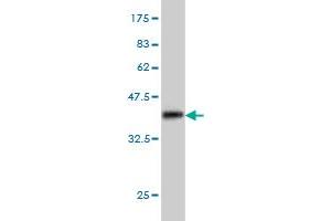 Western Blot detection against Immunogen (36. (MAP3K4 Antikörper  (AA 1201-1300))