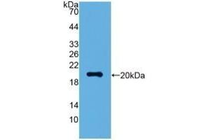Detection of Recombinant VSNL1, Human using Polyclonal Antibody to Visinin Like Protein 1 (VSNL1) (VSNL1 Antikörper  (AA 39-184))