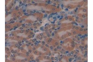 Immunohistochemistry (IHC) image for anti-E3 ubiquitin-protein ligase MIB2 (MIB2) (AA 546-784) antibody (ABIN7439507)