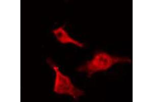 ABIN6267467 staining NIH-3T3 by IF/ICC. (CDC25B Antikörper  (pSer323))