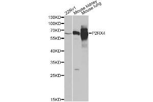 Western blot analysis of extracts of various cell lines, using P2RX4 antibody. (P2RX4 Antikörper)