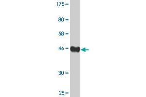 Western Blot detection against Immunogen (44. (AGR2 Antikörper  (AA 1-175))