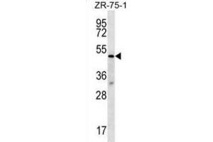 Western Blotting (WB) image for anti-Transducin (Beta)-Like 2 (TBL2) antibody (ABIN2996977) (TBL2 Antikörper)