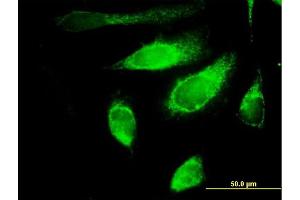 Immunofluorescence of purified MaxPab antibody to POLG2 on HeLa cell. (POLG2 Antikörper  (AA 1-485))
