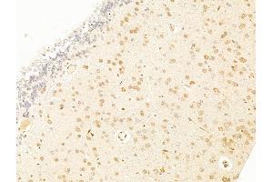 ABIN7094786 and ABIN7098837 at 1/100 staining Rat brain tissue by IHC-P. (TFAP4 Antikörper  (C-Term))