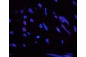 Immunofluorescence analysis of Human uterus tissue using CBX5 Monoclonal Antibody at dilution of 1:200. (CBX5 Antikörper)