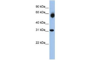 Western Blotting (WB) image for anti-Dehydrogenase/reductase (SDR Family) Member 2 (DHRS2) antibody (ABIN2458636) (DHRS2 Antikörper)