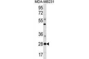 Western Blotting (WB) image for anti-Spi-B Transcription Factor (Spi-1/PU.1 Related) (SPIB) antibody (ABIN3000955) (SPIB Antikörper)