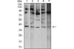 Western blot analysis using ATF4 mouse mAb against K562 (1), A431 (2), Hela (3), HEK293 (4), and Ramos (5) cell lysate. (ATF4 Antikörper  (AA 212-351))