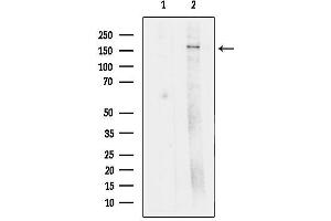 anti-Zinc Finger, FYVE Domain Containing 9 (ZFYVE9) (C-Term) antibody