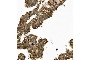 IHC analysis of REN/Renin using anti-REN/Renin antibody (ABIN7602836). (Renin Antikörper  (C-Term))