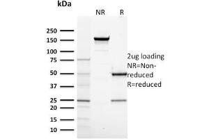 SDS-PAGE Analysis Purified RNA Poll II Mouse Monoclonal Antibody (CTD4H8). (POLR2A/RPB1 Antikörper  (pSer5))