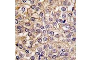 Immunohistochemistry (IHC) image for anti-Interleukin 1 Receptor, Type I (IL1R1) (AA 474-503) antibody (ABIN3031431)