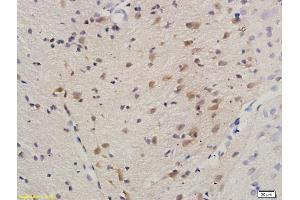 Formalin-fixed and paraffin embedded rat brain labeled with Anti-HDAC3/HD3 Polyclonal Antibody, Unconjugated (ABIN734903) at 1:200 followed by conjugation to the secondary antibody and DAB staining. (HDAC3 Antikörper)