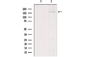 Western blot analysis of extracts from HepG2, using Collagen XIalpha 1 Antibody. (COL11A1 Antikörper  (Internal Region))