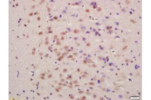 Formalin-fixed and paraffin embedded rat brain labeled with Anti-SLC7A5 Polyclonal Antibody, Unconjugated  at 1:200 followed by conjugation to the secondary antibody and DAB staining (SLC7A5 Antikörper  (AA 101-200))