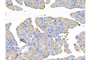 ABIN7094758 and ABIN7098809 at 1/100 staining Rat pancreatic tissue by IHC-P. (TUBB2C Antikörper  (C-Term))