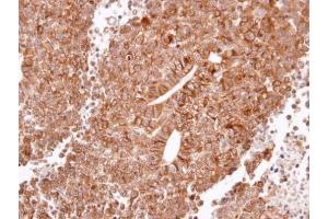 IHC-P Image Immunohistochemical analysis of paraffin-embedded H520 xenograft, using Histamine H2 Receptor, antibody at 1:100 dilution.