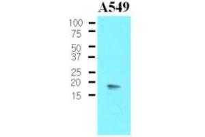 Western Blotting (WB) image for anti-Protein Phosphatase 1, Regulatory (Inhibitor) Subunit 14A (PPP1R14A) (AA 1-147), (N-Term) antibody (ABIN302213) (CPI-17 Antikörper  (N-Term))