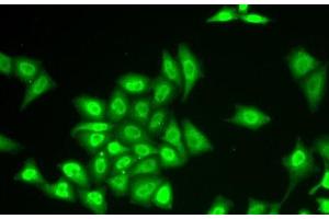 Immunofluorescence analysis of U2OS cells using ZNF217 Polyclonal Antibody (ZNF217 Antikörper)