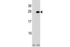 Western blot analysis of ATF3 antibody and 293 cell lysate (2 ug/lane) either nontransfected (Lane 1) or transiently transfected (2) with the ATF3 gene.