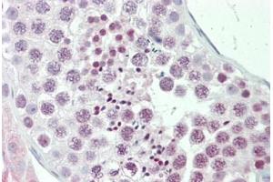Human Testis: Formalin-Fixed, Paraffin-Embedded (FFPE)