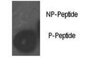 Dot blot analysis of phospho-Rb antibody.