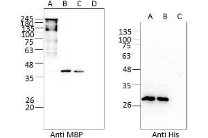 Ataxin2 no tag (AA 1 - 1313), fraction 8 - 10, MBP tag removed; A: MBP-Ataxin With TEV protease Oh; B: after TEV digest; C: after TEV (His) removal; D: after MBP removal (Ataxin 2 Protein (ATXN2) (AA 1-1313) (Strep Tag))
