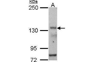 WB Image Sample (30 ug of whole cell lysate) A: HCT116 5% SDS PAGE antibody diluted at 1:500 (POLR3A Antikörper  (N-Term))