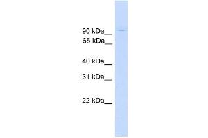 WB Suggested Anti-ZNF224 Antibody Titration: 0. (ZNF224 Antikörper  (Middle Region))