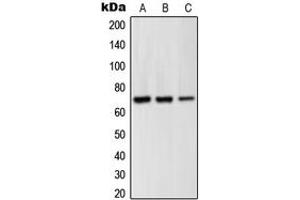 Western blot analysis of GRK6 expression in Jurkat (A), BJAB (B), Ramos (C) whole cell lysates.