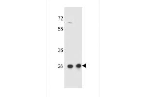 CCDC134 antibody  (C-Term)