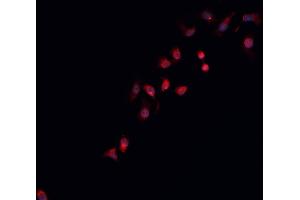 ABIN6266931 staining K-562 cells by IF/ICC. (STEAP3 Antikörper  (N-Term))