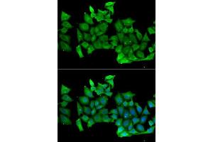 Immunofluorescence analysis of MCF-7 cells using RHOH antibody. (RHOH Antikörper  (AA 1-191))