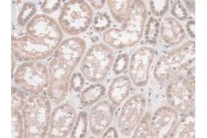 IHC-P analysis of Human Kidney Tissue, with DAB staining. (SYNE2 Antikörper  (AA 6-296))