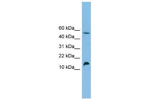 WB Suggested Anti-EPO Antibody Titration: 0. (EPO Antikörper  (Middle Region))