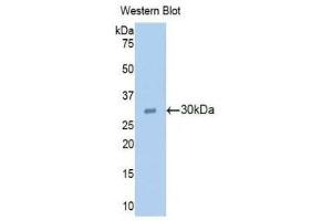 Western Blotting (WB) image for anti-Ribonuclease L (2',5'-Oligoisoadenylate Synthetase-Dependent) (RNASEL) (AA 358-583) antibody (ABIN1860458) (RNASEL Antikörper  (AA 358-583))