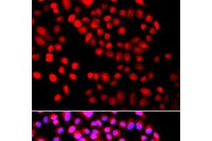 Immunofluorescence analysis of A549 cells using SETD6 Polyclonal Antibody (SETD6 Antikörper)