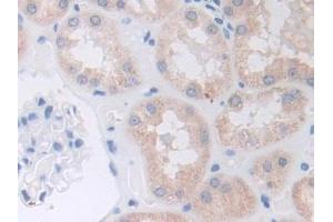 IHC-P analysis of Human Kidney Tissue, with DAB staining. (ADAM9 Antikörper  (AA 440-680))