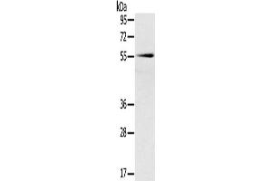 Western Blotting (WB) image for anti-Solute Carrier Family 16, Member 10 (Aromatic Amino Acid Transporter) (SLC16A10) antibody (ABIN2427205) (SLC16A10 Antikörper)