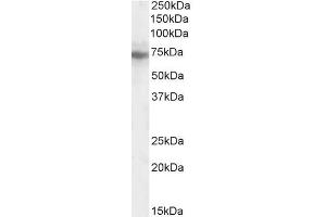 Western Blotting (WB) image for anti-Intraflagellar Transport Protein 74 Homolog (IFT74) (C-Term) antibody (ABIN185213)