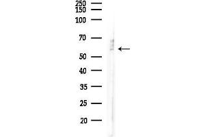 anti-Alpha2 Antiplasmin (SERPINF2) (C-Term) antibody