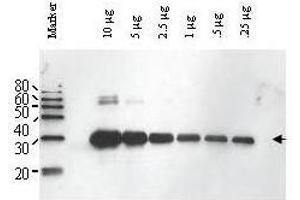 Western blot using  Affinity Purified anti-Yeast ULP-1 antibody shows detection of a truncated ULP-1 fusion protein (arrowhead). (ULP1 Antikörper)