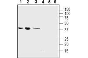 Western Blotting (WB) image for anti-Uncoupling Protein 2 (Mitochondrial, Proton Carrier) (UCP2) (AA 153-164), (Intracellular) antibody (ABIN7043873)